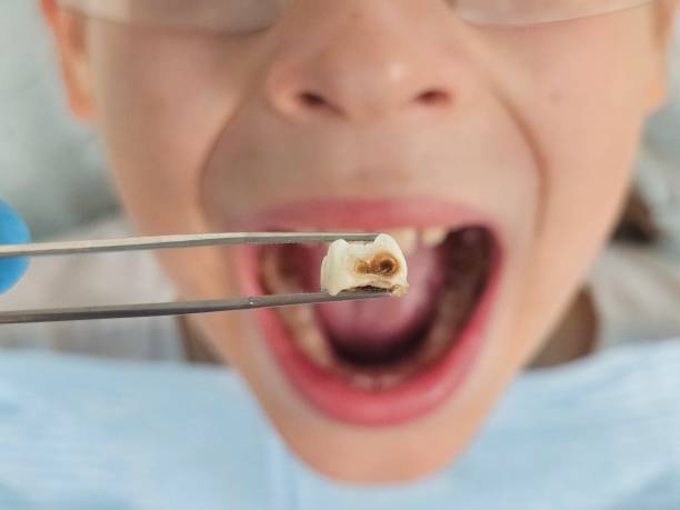 Best Emergency Care for Gum Disease in Hokendauqua, PA